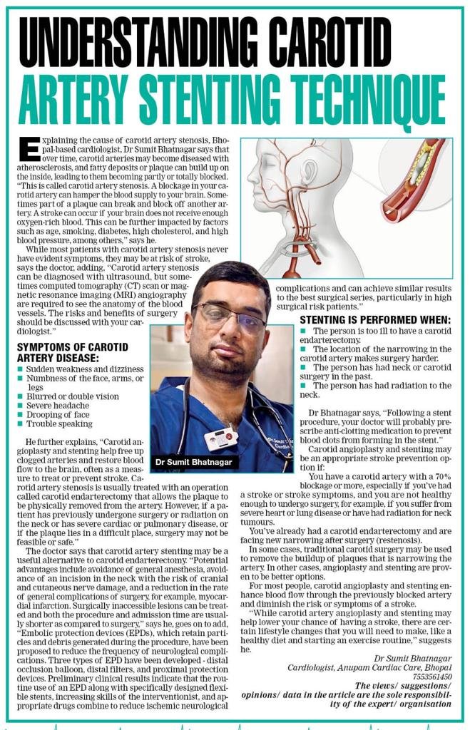Article on carotid artery stenting technique